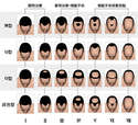 附圖
