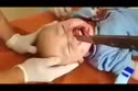 附圖