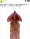 附圖