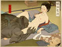 附圖