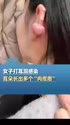 附圖