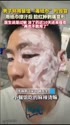 附圖