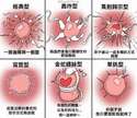 附圖