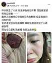 附圖