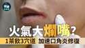 附圖
