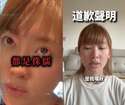附圖