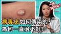 附圖