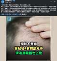附圖