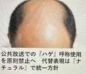 附圖