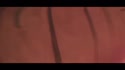 附圖